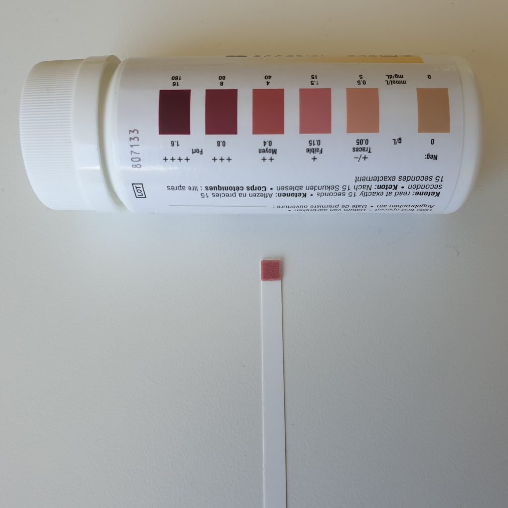 Meten of je in ketose bent met ketostix