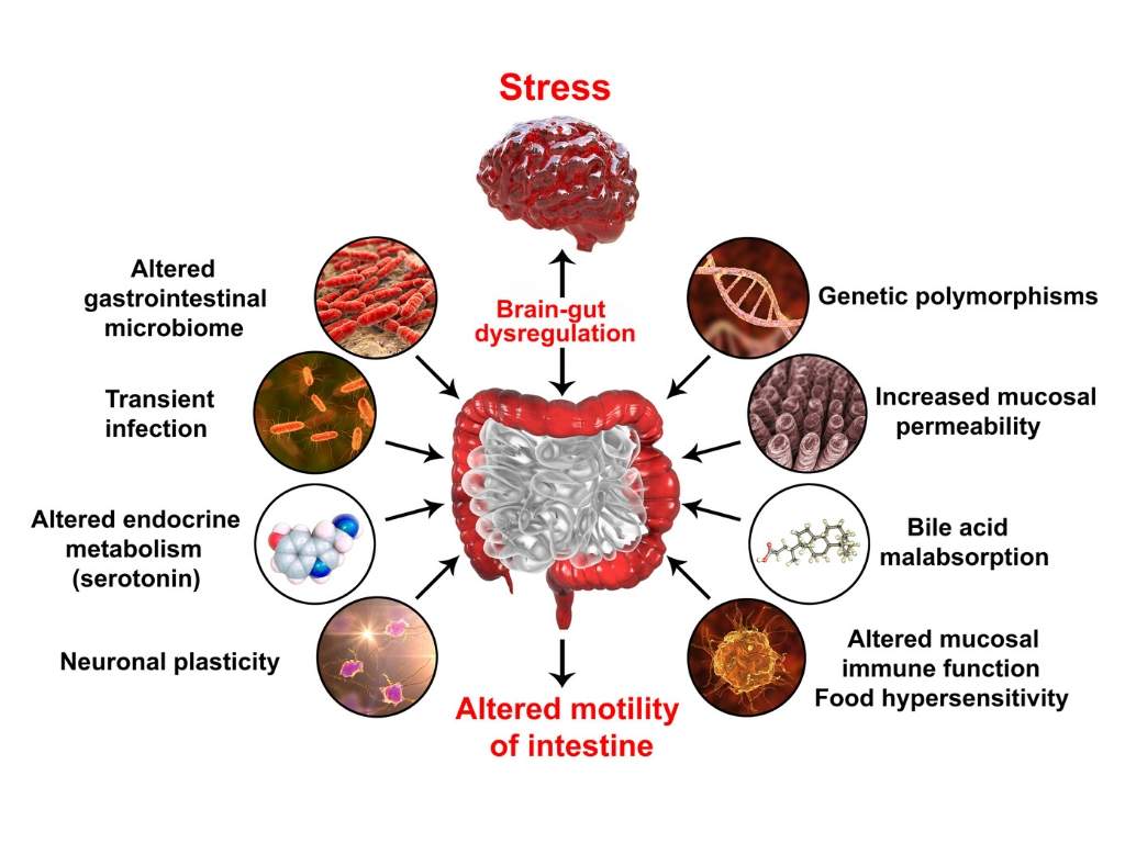 Stress en IBS